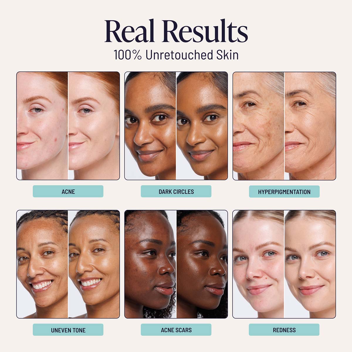 Complexion Perfecting Set