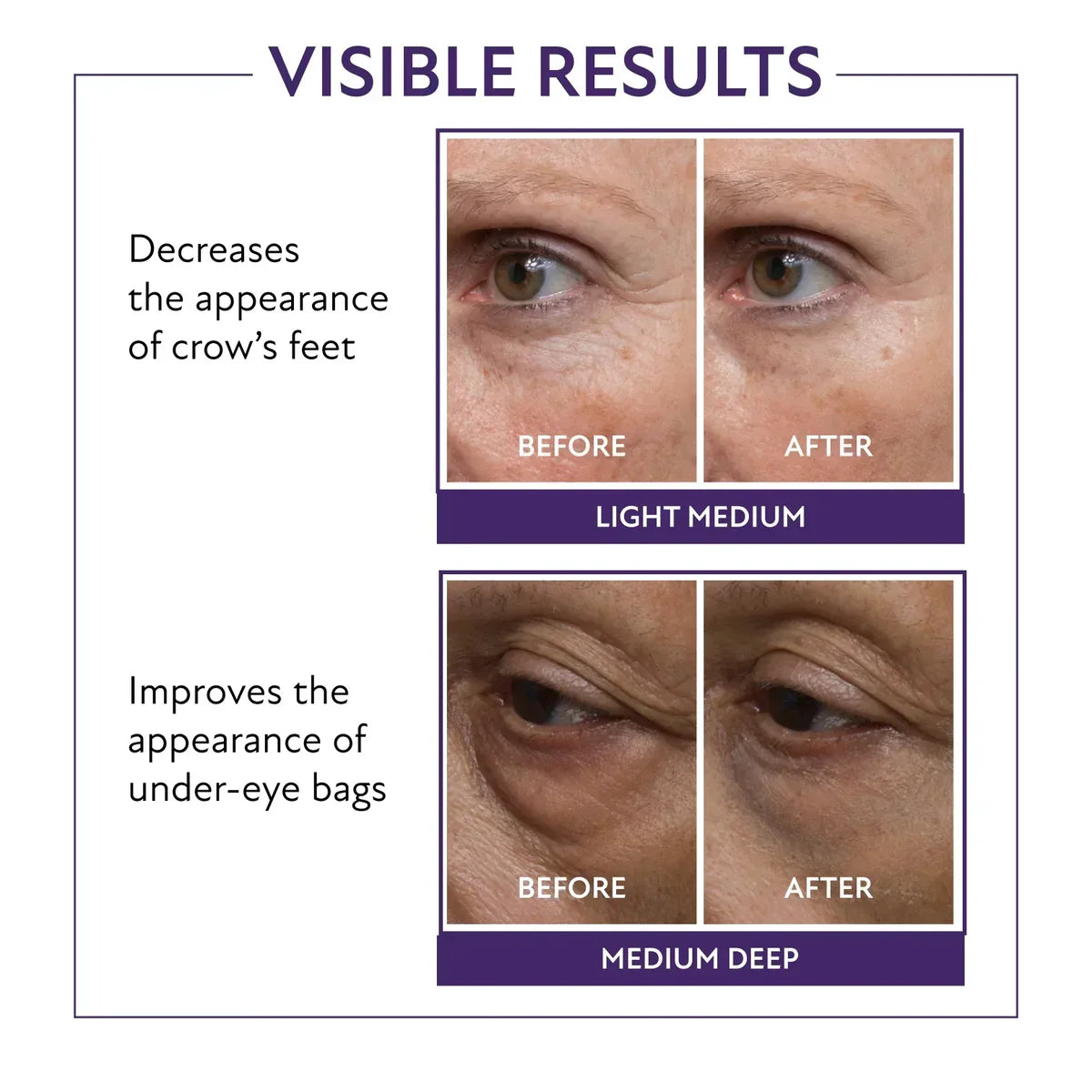 60-Second Eye Effects